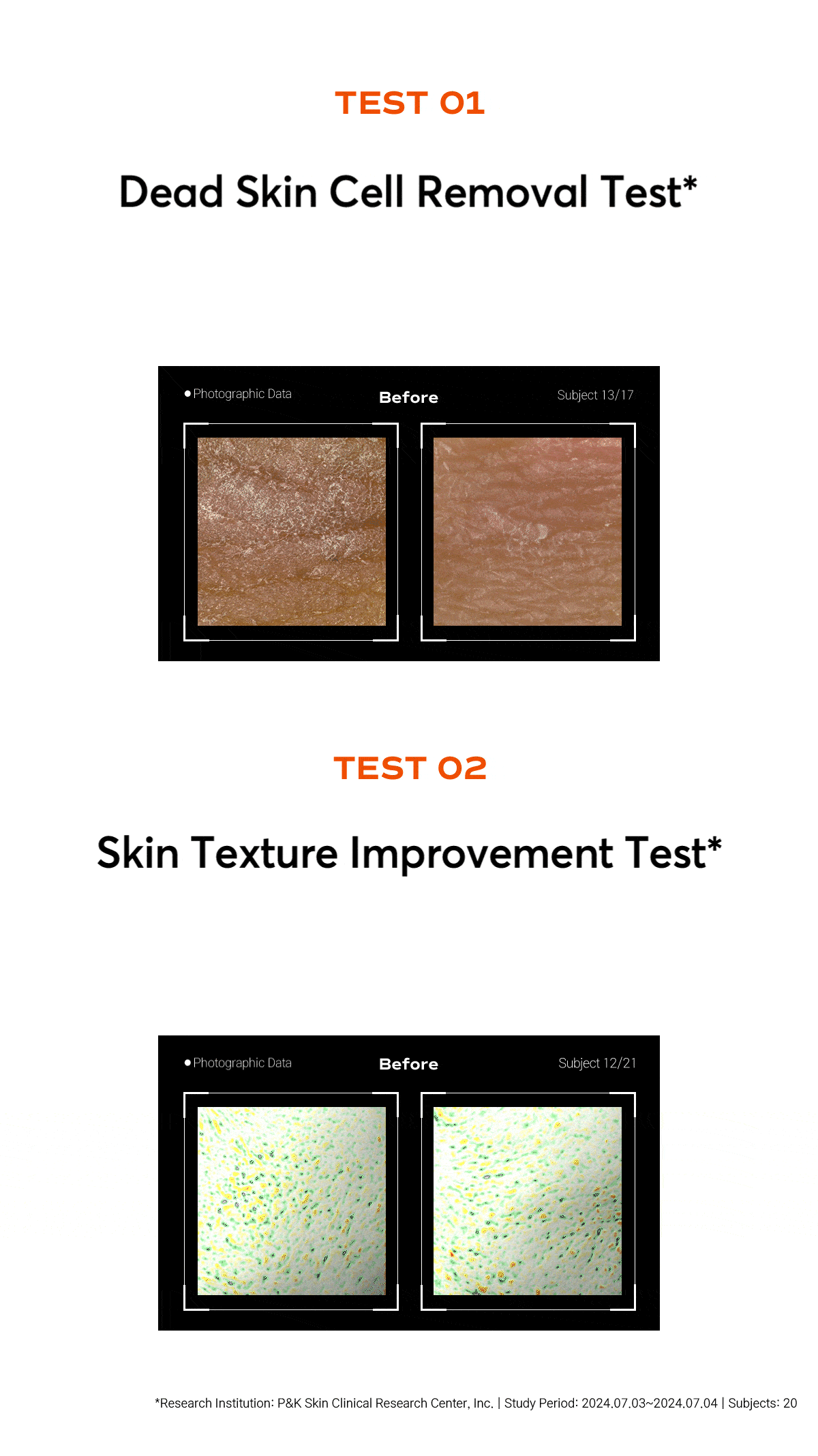 Banobagi Alpha Radiance Mild Peeling Foam ( Aydınlatıcı Leke Bakım Peeling)