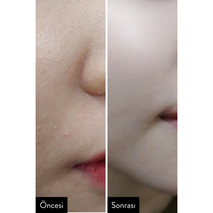 Aha Bha Pha 30 Days Miracle Cream Onarıcı Centella Kremi 60gr