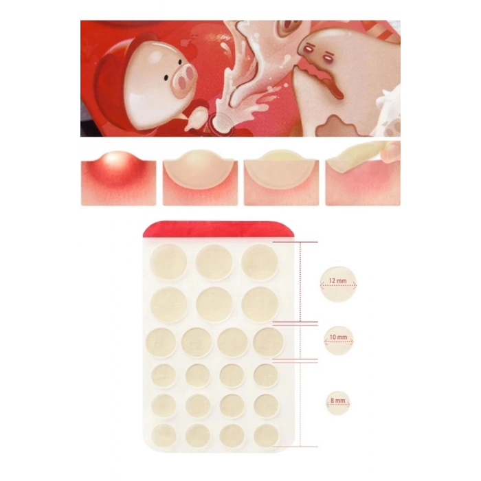 Witch Piggy Hell Pore Blemish Akne Sivilce Söndürücü Şeffaf Bant 44lü