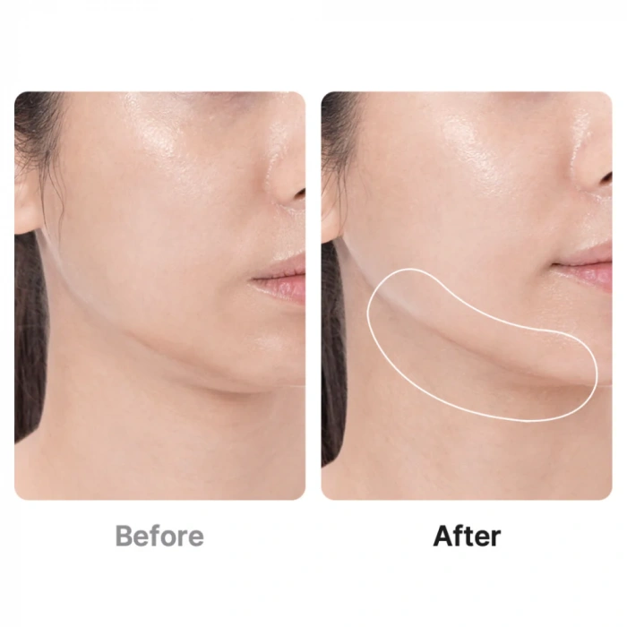 medicube - AGE-R Booster Pro Mini White (GLOBALCARE)