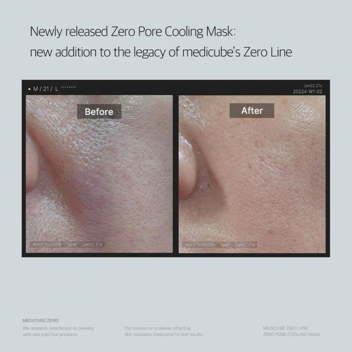 Medicube ZERO PORE COOLING MASK ( Sıfır Gözenek Maskesi) ( GLOBALCARE)