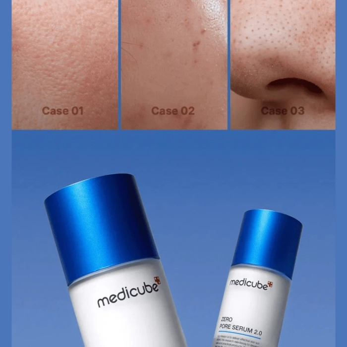 medicube - Zero Pore Serum (Gözenek Karşıtı Serum)(GLOBALCARE)