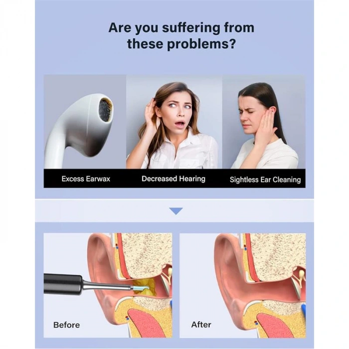 BEBIRD T5 3MP KAMERA 3.5MM LENS ŞARJLI WIFI GÖRÜNTÜLÜ KULAK TEMİZLEYİCİ SİYAH RENK