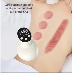 Sıcaklık Emişli Bardak Çekme Terapisi, Vakumlu Masaj Aleti,Terapi Cihazı Masaj Cihazı (5047)