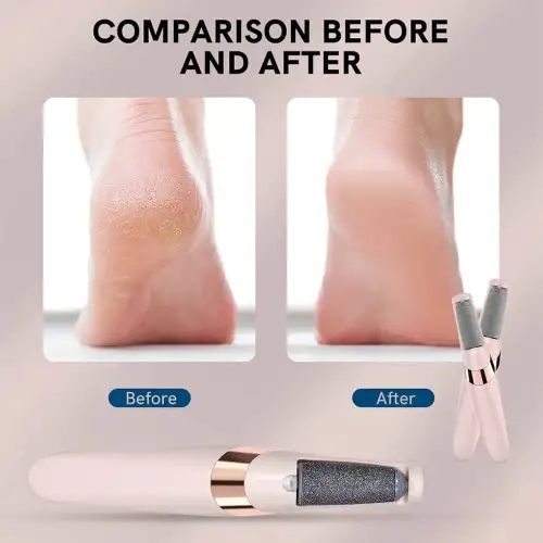 Egonex Pedi Şarjlı Ayak Törpüsü Şarjlı