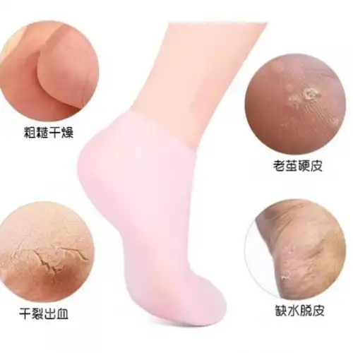 Silikon Nemlendirici Çorap Ayak Bakım Çorabı Pembe