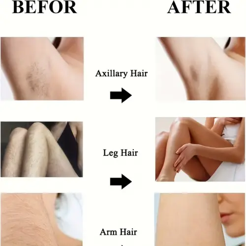 Crystal Eraser Epilasyon Aleti Tüy Silgisi Kristal Epilatör