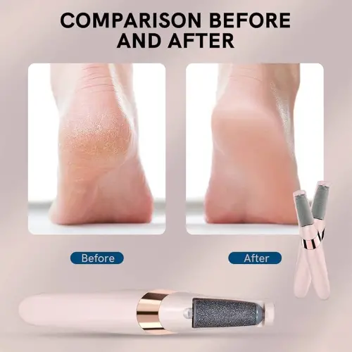 Egonex Pedi Şarjlı Ayak Törpüsü Şarjlı