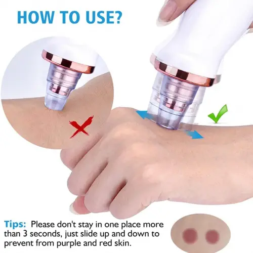 Egonex Şarjlı Siyah Nokta Temizleme Cihazı 5 Başlıklı