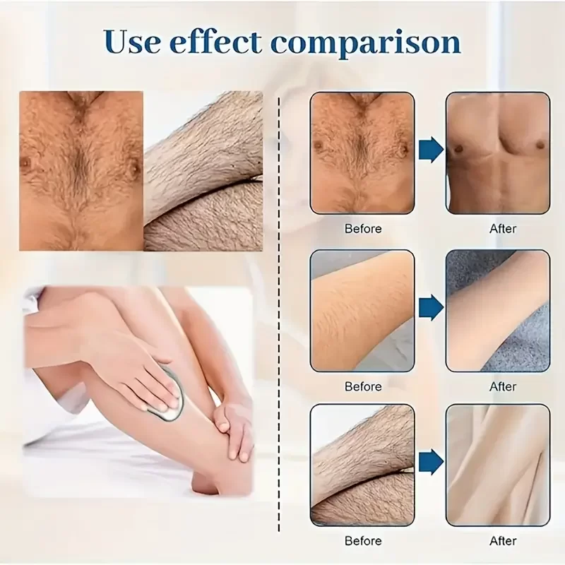 Egonex Ağrısız Nano Tüy Alma Cihazı