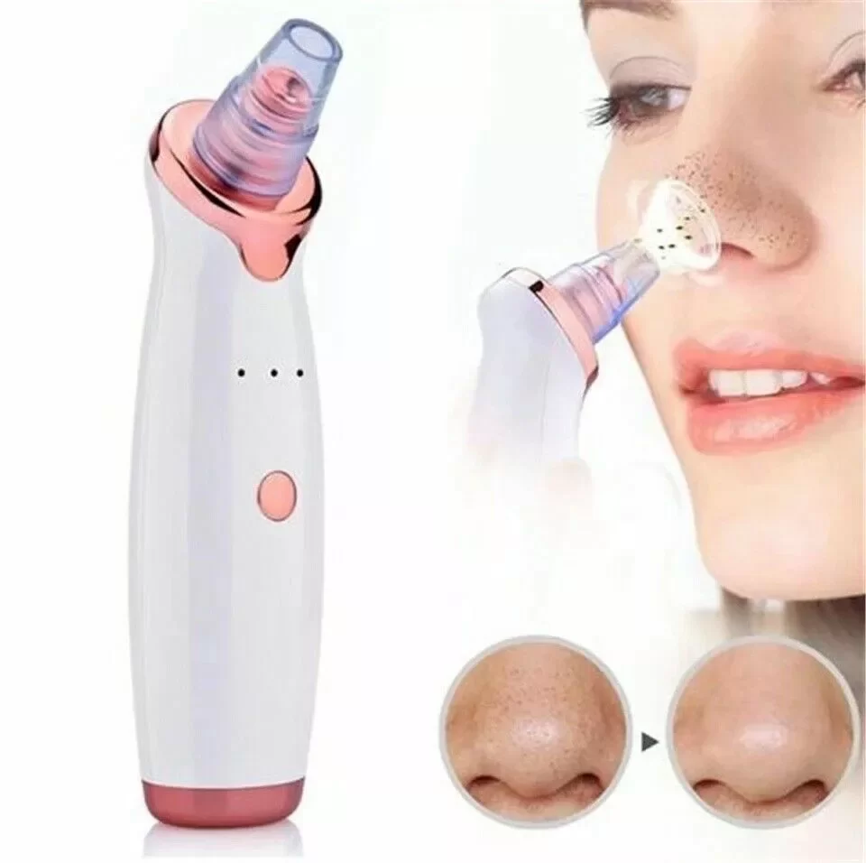 Egonex Şarjlı Siyah Nokta Temizleme Cihazı 5 Başlıklı
