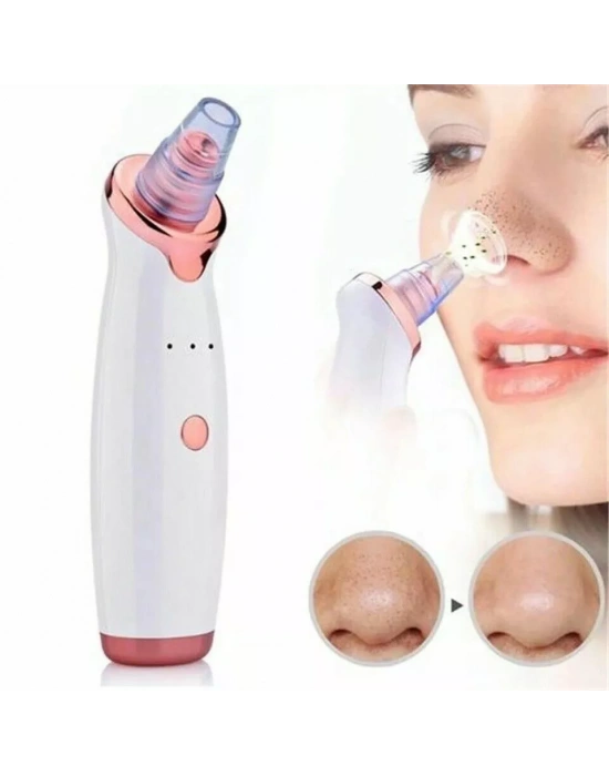 Egonex Şarjlı Siyah Nokta Temizleme Cihazı 5 Başlıklı