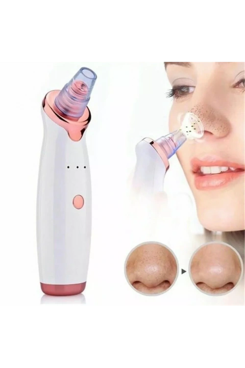 Egonex Şarjlı Siyah Nokta Temizleme Cihazı 5 Başlıklı