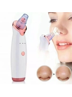 Egonex Şarjlı Siyah Nokta Temizleme Cihazı 5 Başlıklı