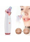 Egonex Şarjlı Siyah Nokta Temizleme Cihazı 5 Başlıklı