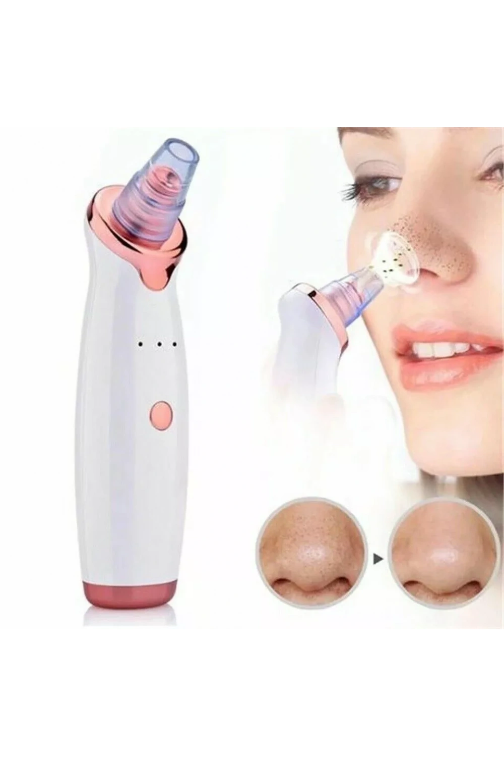 Egonex Şarjlı Siyah Nokta Temizleme Cihazı 5 Başlıklı