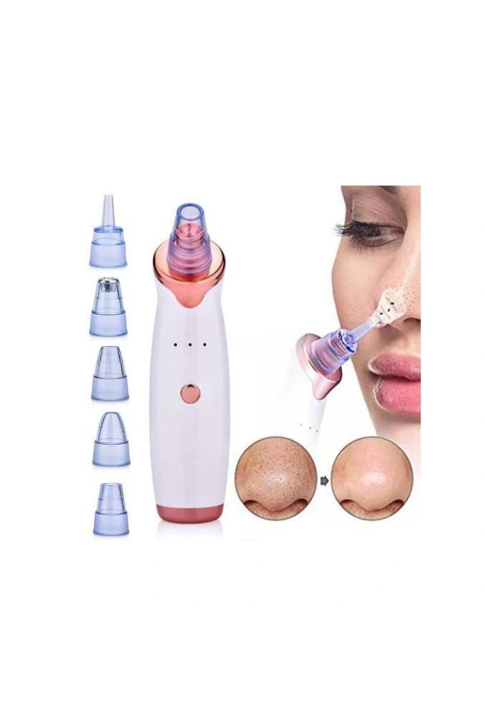 Egonex Şarjlı Siyah Nokta Temizleme Cihazı 5 Başlıklı