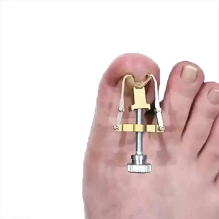 AsilTech Batık Tırnak Düzeltme Aleti