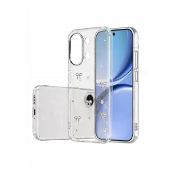 Newface Xiaomi Poco X8 Pro Max Fiyonk Desenli Kapak - Desen 5