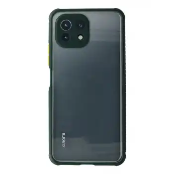 Xiaomi Mi 11 Lite Kılıf Miami Şeffaf Silikon - Koyu Yeşil