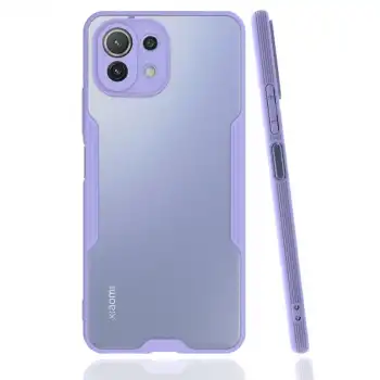 Xiaomi Mi 11 Lite Kılıf Platin Silikon - Lila