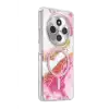 Onegif Xiaomi Redmi 14c Lotus Simli Magsafe Kapak - Pembe