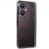 Vivo Y27 Kılıf Razer Lensli Silikon - Mor