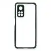 Xiaomi Mi 10t Pro Kılıf Miami Şeffaf Silikon - Koyu Yeşil