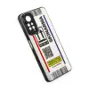 Xiaomi Redmi Note 11 Pro Kılıf Mirror Desenli Kapak - Mirror - 7