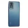 Xiaomi Redmi Note 11 Pro Kılıf Razer Lensli Silikon - Açık Mavi