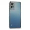 Xiaomi Redmi Note 11 Pro Kılıf Razer Lensli Silikon - Gümüş