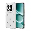 Xiaomi Redmi Note 15 Pro Plus 5g Fiyonk Desenli Kapak - Desen 7