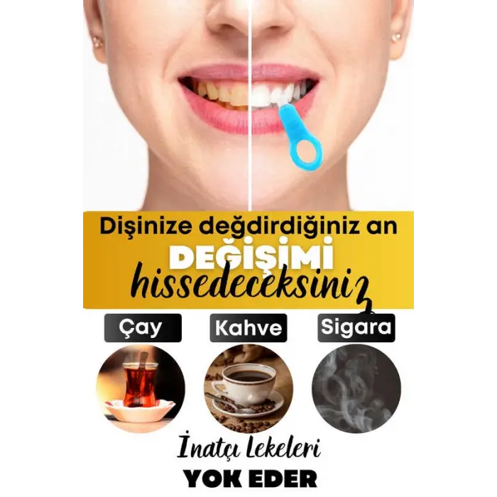 Diş Leke Silgisi 1 Aparatlı + 5 Yedek Süngerli Set 1 Paket