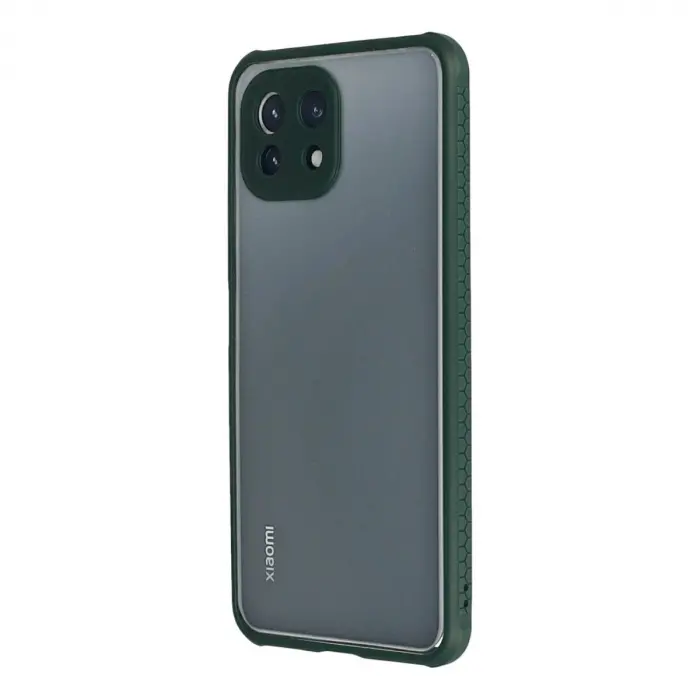 Mi 11 Lite Kılıf Miami Şeffaf  - Koyu Yeşil