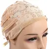 Peruk Dikim Filesi / Sarı