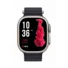 Ultra Akıllı Saat 49 Mm Çift Kordonlu Arama Cevaplama Bluetooth Bağlantılı