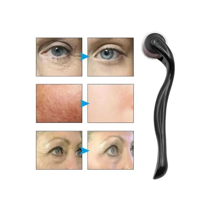 Dermaroller Titanyum 540 Iğneli 1 Mm Saç Kaş Sakal Serum Kullanıma Uygun