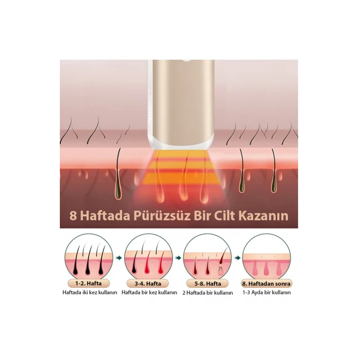 EZERE IPL Buz Lazer Epilasyon 999.999 Atim Otomatik/manuel Dokunmatik Ekran Agrisiz Vücut Yüz Cihazi-(5775)