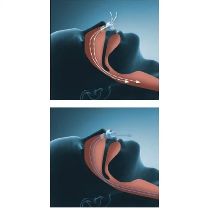 Horlama Önleyici Rahat Uyku Atı