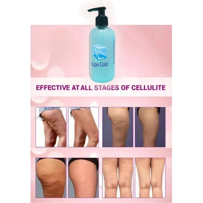 Lipo Cold  Masaj Kremi 250 ml x 1 Adet