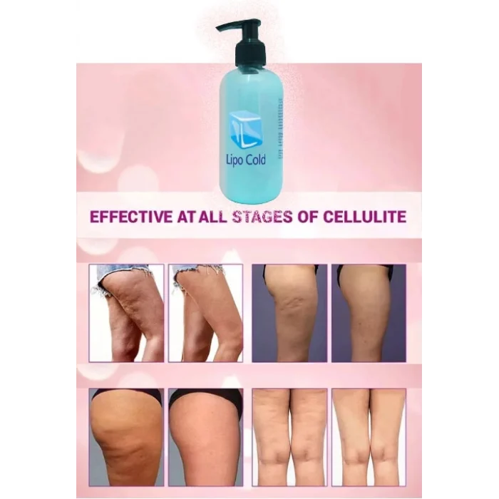 Lipo Cold Yeni Görünümünüze Krem 250 ml