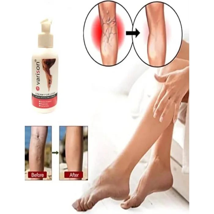 On Sellülit Bacak Bakım Kremi 120 ml