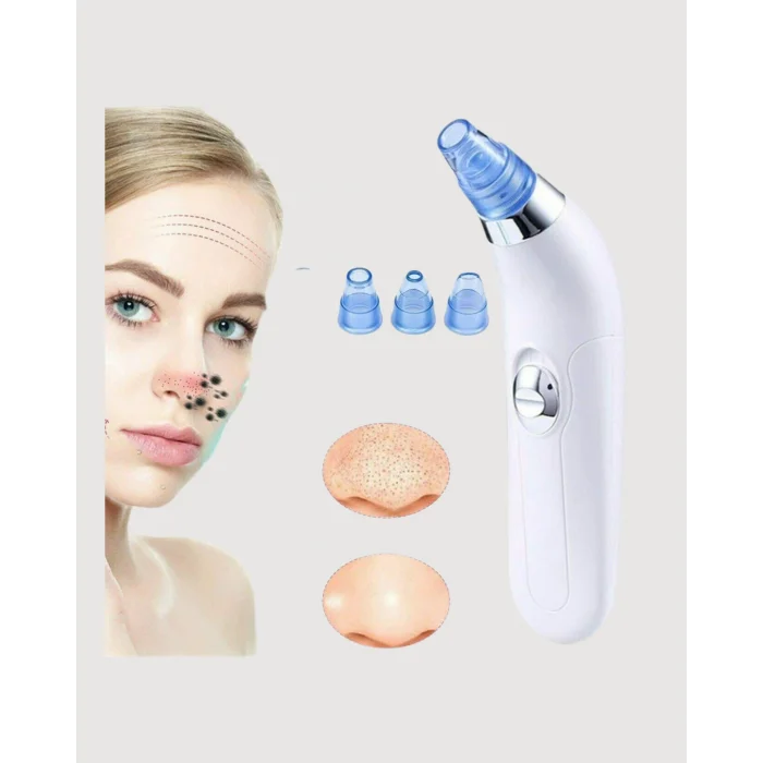 USB Destekli 4 Başlıklı Siyah Nokta Vakum Cihazı – Gözenek Temizleyici ve Cilt Yenileyici Bakım Aleti