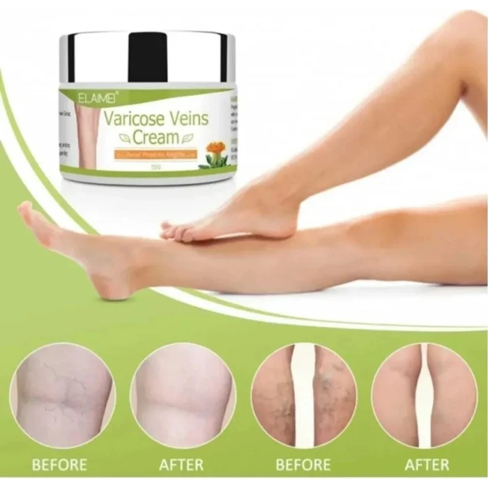 Varicose Kremi 100 ml
