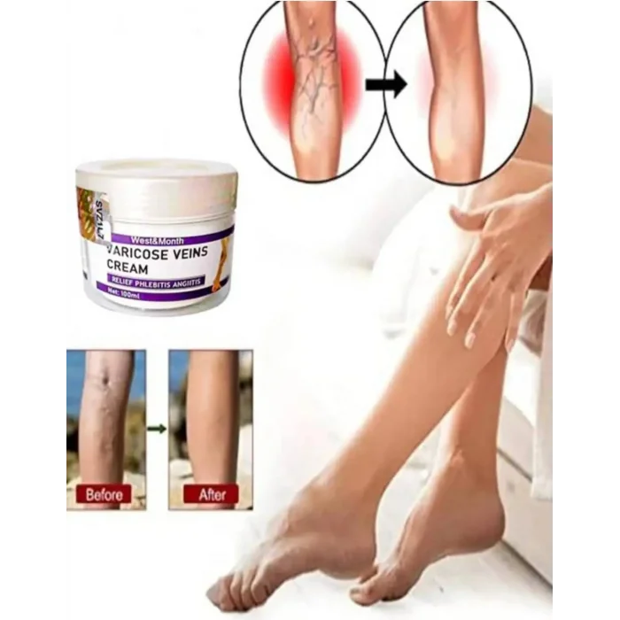 West & Month V.ricose Ve.n Va.ris KREMI100 ml 2 Adet
