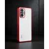 Xiaomi Redmi Note 10 Pro Kılıf Razer Lensli Silikon - Gümüş