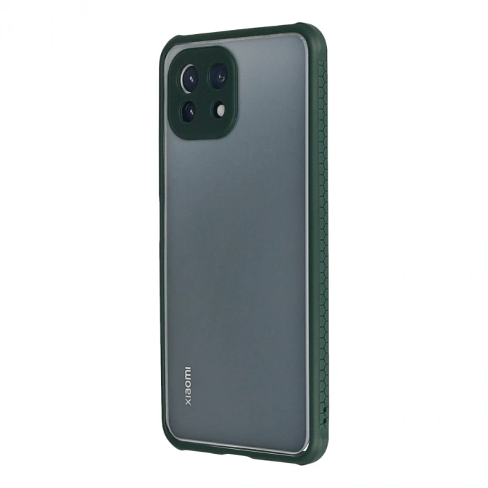 Xiaomi Mi 11 Lite Kılıf Miami Şeffaf Silikon - Koyu Yeşil