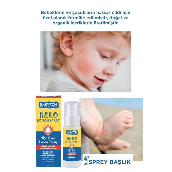 Anlık Yatıştırıcı Hero Losyon Sprey