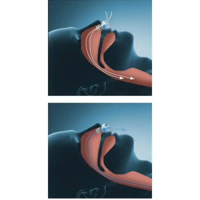 Horlama Önleyici Rahat Uyku Aparatı