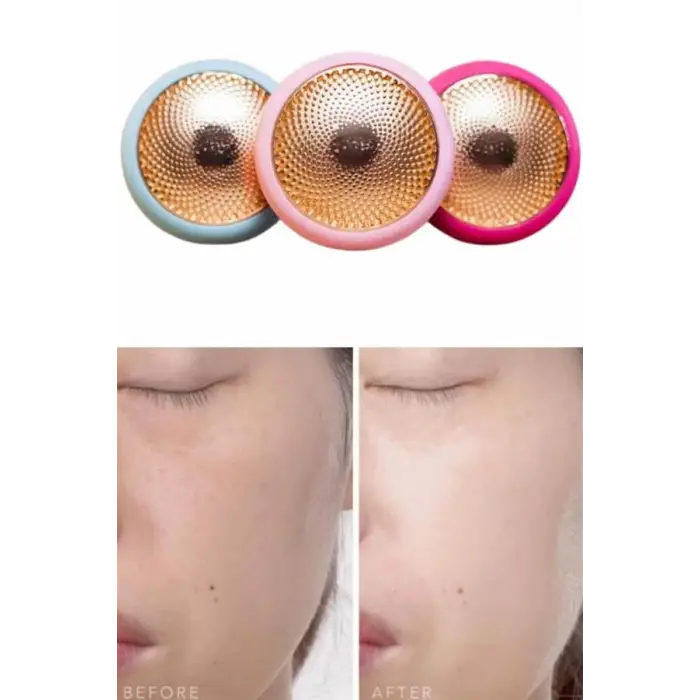 Mini Saç Derisi Masaj Aleti Led Işık Terapisi Cildi Yatıştırır ve Dengeler